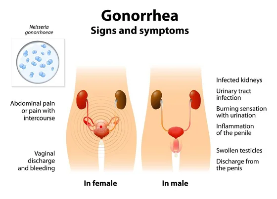 Infections
