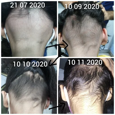 Hair