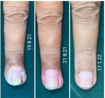 Nail