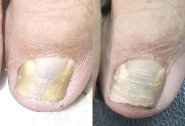 Nail