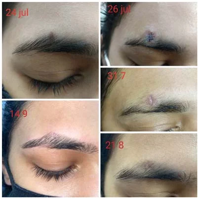 Pre and Post