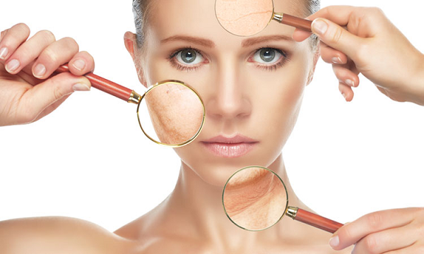 Wrinkle Reduction