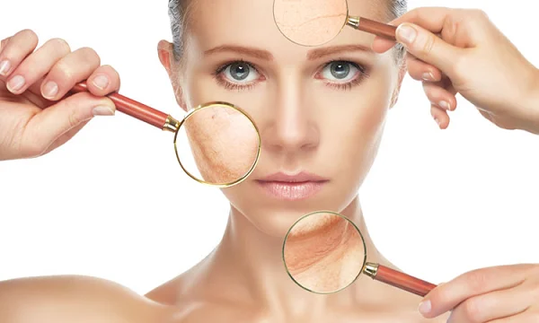 Wrinkle Reduction