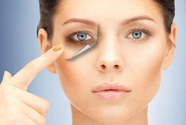 Periorbital Rejuvenation